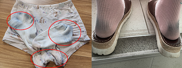 ▲ (왼쪽부터) 한 패스트 패션 브랜드의 바지를 착용 뒤 속옷과 양말에 물이든 모습, 명품 브랜드의 신발 착용 뒤 양말에 이염된 모습 