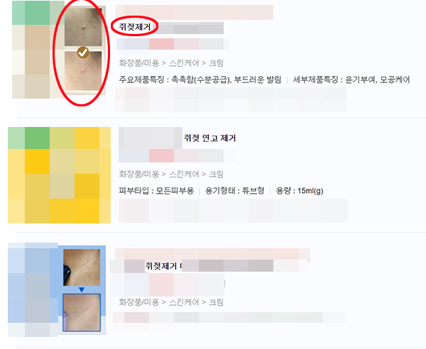 ▲ 식약처가 온라인에서 쥐젖 제거를 표방해 유통·판매하는 행위를 불법으로 여기고 있음에도 온라인몰에서는 관련 상품이 여전히 판매되고 있다