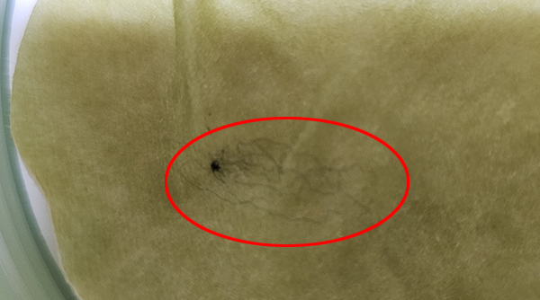 ▲ 화장품 패드에서 알 수 없는 이물이 나왔다