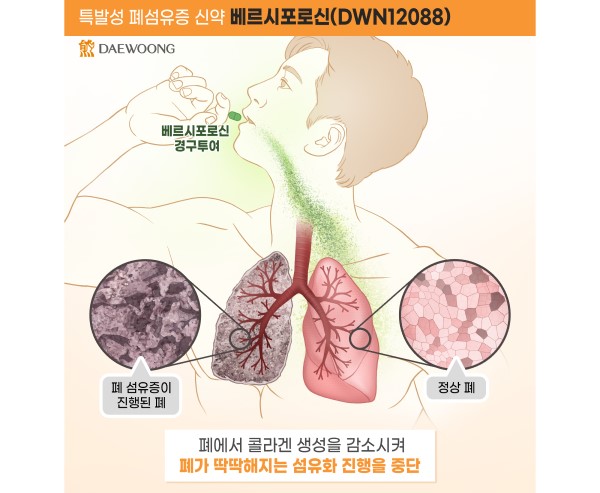 ▲베르시포로신(DWN12088) 작용 기전
