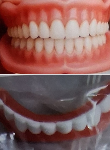 ▲(위쪽부터)광고 이미지엔 자연스러운 치아 형태 틀니지만 실제 배송은 장난감같은 모형이 도착했다